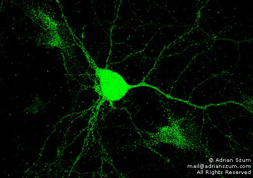 Rat hippocampal neuron with Endogenous Arc by confocal microscop